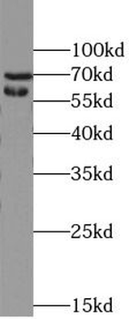NF2 Rabbit Polyclonal Antibody