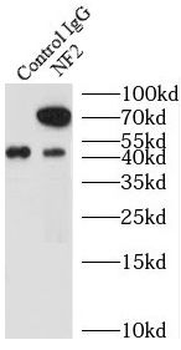 NF2 Rabbit Polyclonal Antibody