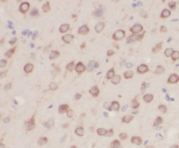 NF2 Rabbit Polyclonal Antibody