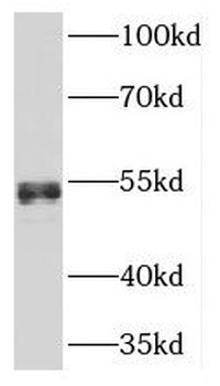 NFIB Rabbit Polyclonal Antibody