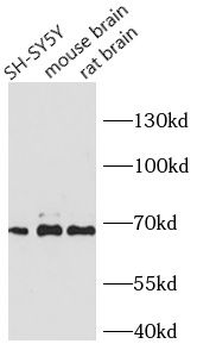 NEFL Antibody