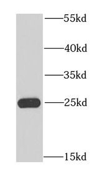NFU1 Rabbit Polyclonal Antibody