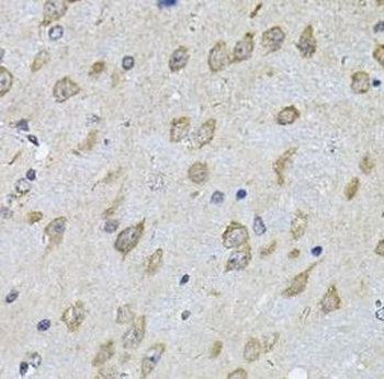NFU1 Rabbit Polyclonal Antibody
