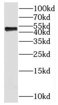 SLC9B2 Rabbit Polyclonal Antibody