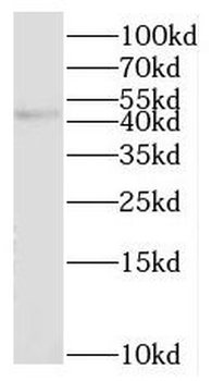NHLRC1 Rabbit Polyclonal Antibody