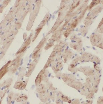 NHLRC1 Rabbit Polyclonal Antibody
