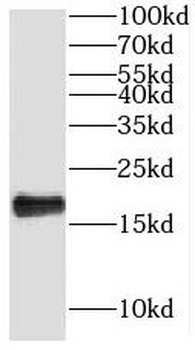 NHP2 Antibody