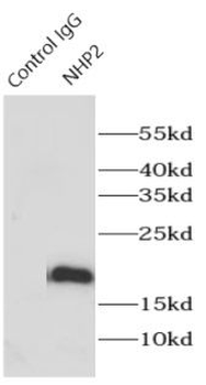 NHP2 Antibody