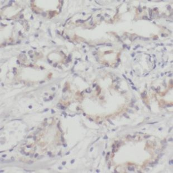 NHP2 Antibody
