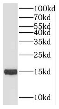 SNU13 Antibody