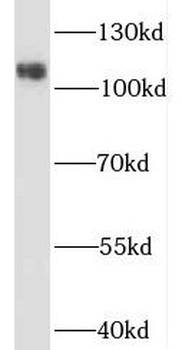 NCSTN Rabbit Polyclonal Antibody