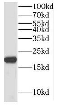 NIP7 Rabbit Polyclonal Antibody