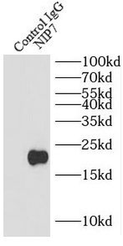 NIP7 Rabbit Polyclonal Antibody