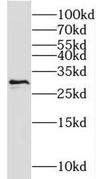 NIPSNAP3A Rabbit Polyclonal Antibody
