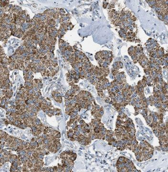 NIPSNAP3A Rabbit Polyclonal Antibody
