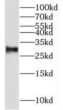 NIPSNAP3B Rabbit Polyclonal Antibody