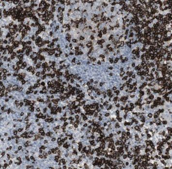 NIPSNAP3B Rabbit Polyclonal Antibody