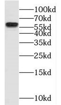 NKD2 Rabbit Polyclonal Antibody