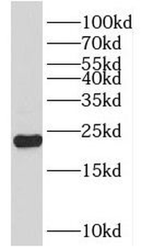NKIRAS2 Antibody