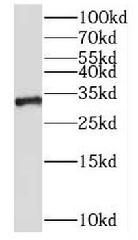 NKX1 2 Rabbit Polyclonal Antibody