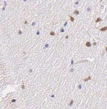 NKX1 2 Rabbit Polyclonal Antibody
