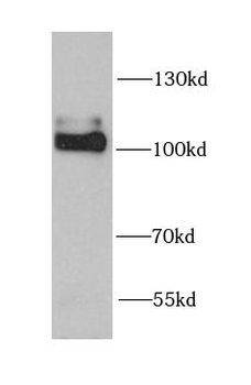 NLGN4Y Rabbit Polyclonal Antibody