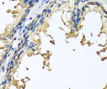 NLGN4Y Rabbit Polyclonal Antibody
