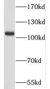 NLRP2 Rabbit Polyclonal Antibody