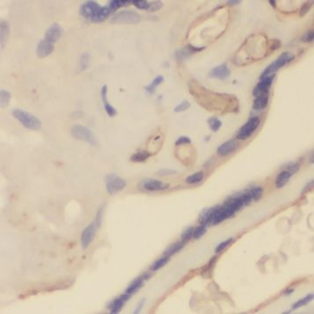 NLRP2 Rabbit Polyclonal Antibody