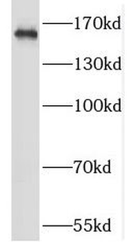 GRIN2A Rabbit Polyclonal Antibody
