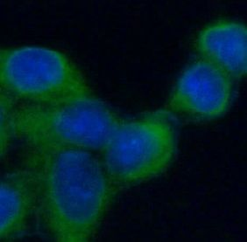 GRIN2A Rabbit Polyclonal Antibody