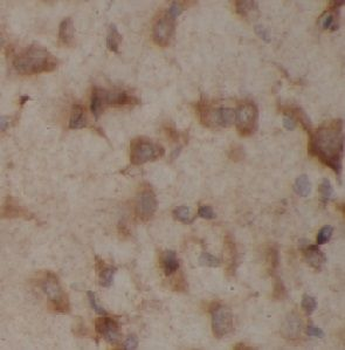 GRIN2A Rabbit Polyclonal Antibody