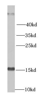 NME2 Rabbit Polyclonal Antibody