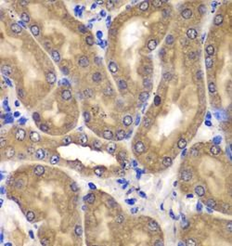 NME2 Rabbit Polyclonal Antibody