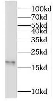 NME3 Rabbit Polyclonal Antibody