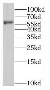 NMT1 Rabbit Polyclonal Antibody