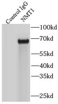 NMT1 Rabbit Polyclonal Antibody
