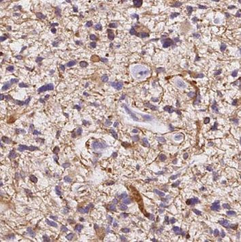 NMT1 Rabbit Polyclonal Antibody