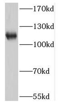 NNT Rabbit Polyclonal Antibody