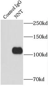 NNT Rabbit Polyclonal Antibody