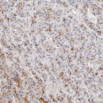 NNT Rabbit Polyclonal Antibody