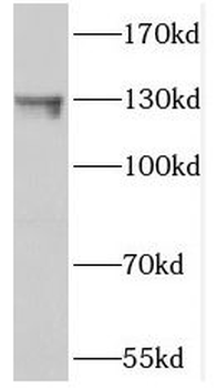 NOL6 Rabbit Polyclonal Antibody