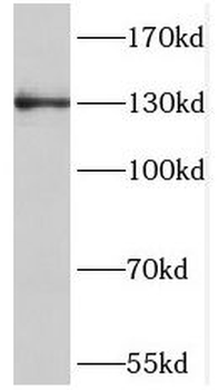 NOL6 Rabbit Polyclonal Antibody