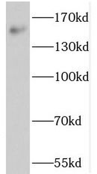 NOL8 Rabbit Polyclonal Antibody