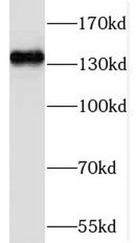NOMO1 Rabbit Polyclonal Antibody