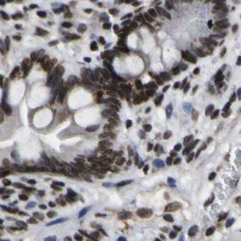 NOMO1 Rabbit Polyclonal Antibody