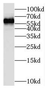 NOP56 Rabbit Polyclonal Antibody