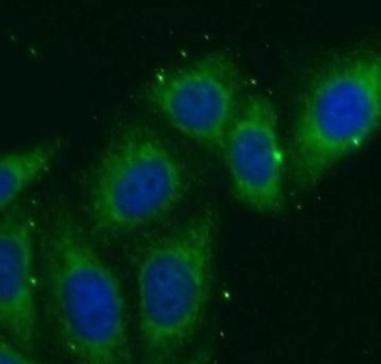 NOSTRIN Rabbit Polyclonal Antibody