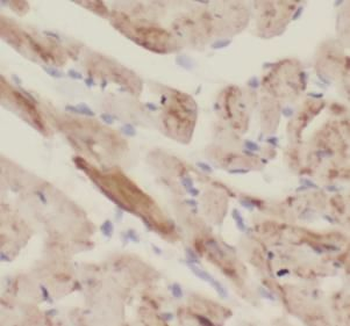NOSTRIN Rabbit Polyclonal Antibody