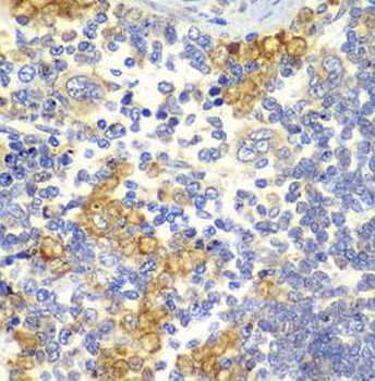 NOTCH1 Antibody